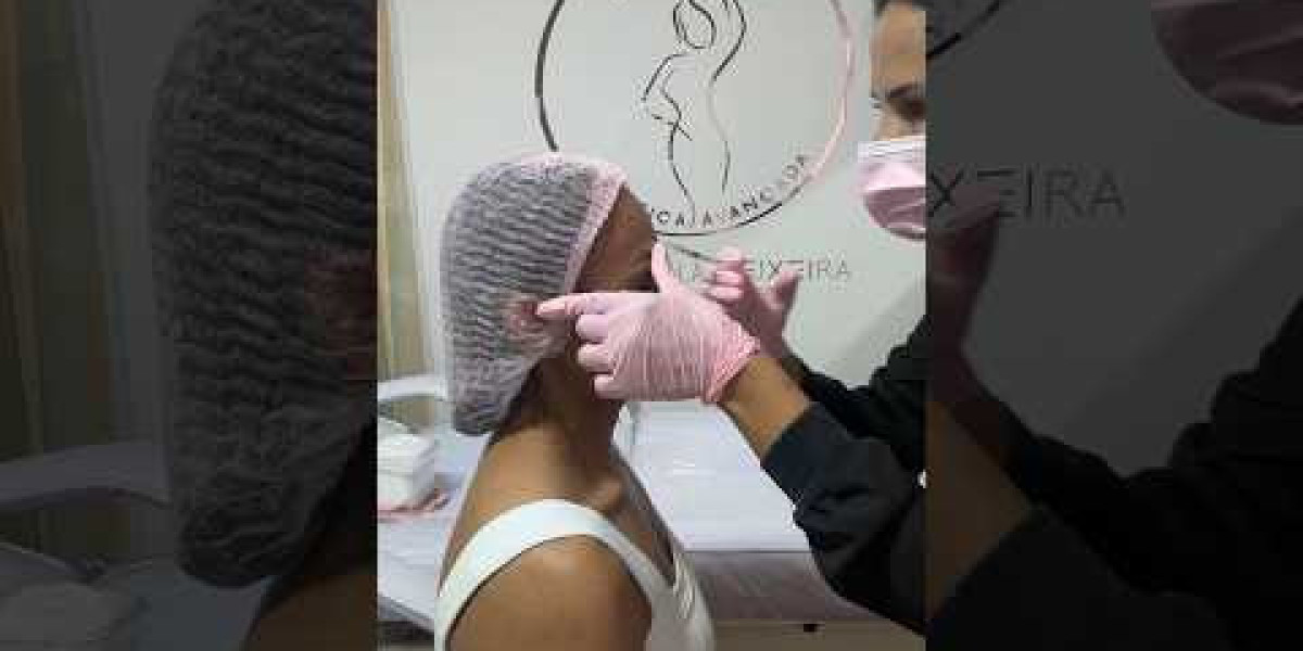 Toxina Botulínica Aplicada à Harmonização Facial Atualização