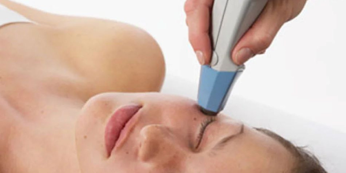 Redefine Your Body with Exilis Treatment in Delhi at Akarabyaayna